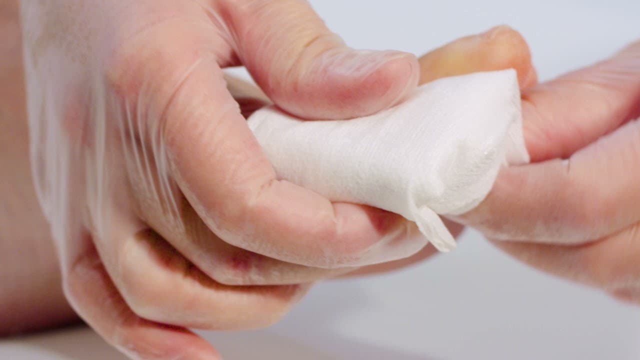 ¿Qué diferencia hay entre gel con plata y gel de alginato?